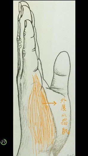 手痛肌肉僵硬不輕忽：小指頭僵僵的，很久了！
